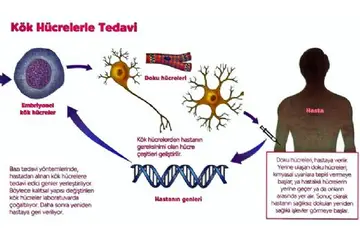 Kök Hücre Hastalıkları Belirtileri ve Tedavisi
